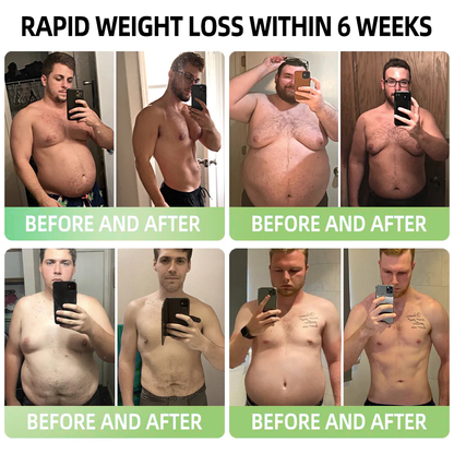 𝑷𝑬𝑨𝑹𝑳𝑴𝑶𝑶𝐍® 𝑰𝒄𝒆 𝑺𝒊𝒍𝒌 𝑰𝒐𝒏-𝑭𝒊𝒃𝒆𝒓 𝑹𝒆𝒑𝒂𝒊𝒓 𝑺𝒉𝒂𝒑𝒊𝒏𝒈 𝑺𝒉𝒐𝐫𝐭𝐬 🎁𝐅𝐚𝐭 𝐛𝐮𝐫𝐧𝐢𝐧𝐠, 𝐬𝐤𝐢𝐧 𝐭𝐢𝐠𝐡𝐭𝐞𝐧𝐢𝐧𝐠, 𝐩𝐫𝐨𝐦𝐨𝐭𝐢𝐧𝐠 𝐜𝐢𝐫𝐜𝐮𝐥𝐚𝐭𝐢𝐨𝐧 & 𝐥𝐲𝐦𝐩𝐡𝐚𝐭𝐢𝐜 𝐝𝐫𝐚𝐢𝐧𝐚𝐠𝐞 𝐟𝐨𝐫 𝐡𝐨𝐥𝐢𝐬𝐭𝐢𝐜 𝐡𝐞𝐚𝐥𝐭𝐡