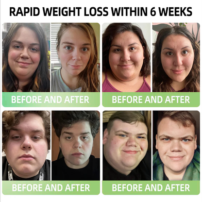 𝑷𝑬𝑨𝑹𝑳𝑴𝑶𝑶𝐍® 𝑰𝒄𝒆 𝑺𝒊𝒍𝒌 𝑰𝒐𝒏-𝑭𝒊𝒃𝒆𝒓 𝑹𝒆𝒑𝒂𝒊𝒓 𝑺𝒉𝒂𝒑𝒊𝒏𝒈 𝑺𝒉𝒐𝐫𝐭𝐬 🎁𝐅𝐚𝐭 𝐛𝐮𝐫𝐧𝐢𝐧𝐠, 𝐬𝐤𝐢𝐧 𝐭𝐢𝐠𝐡𝐭𝐞𝐧𝐢𝐧𝐠, 𝐩𝐫𝐨𝐦𝐨𝐭𝐢𝐧𝐠 𝐜𝐢𝐫𝐜𝐮𝐥𝐚𝐭𝐢𝐨𝐧 & 𝐥𝐲𝐦𝐩𝐡𝐚𝐭𝐢𝐜 𝐝𝐫𝐚𝐢𝐧𝐚𝐠𝐞 𝐟𝐨𝐫 𝐡𝐨𝐥𝐢𝐬𝐭𝐢𝐜 𝐡𝐞𝐚𝐥𝐭𝐡